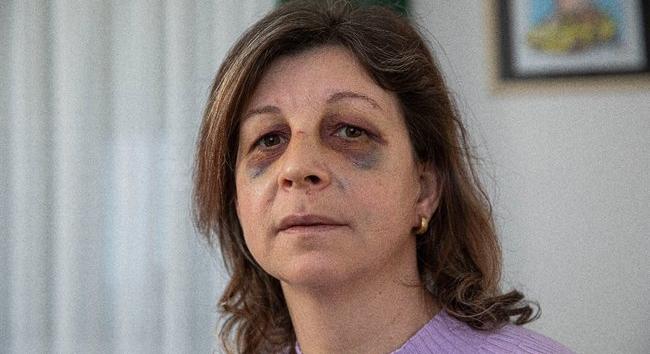 "Azt hajtogatta, ne visítsak" - megrázó vallomást tett a HÉV-en megtámadott családanya