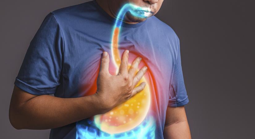 Mellkasi fájdalom, krákogás, fogromlás: furcsa tüneteket okozhat a reflux