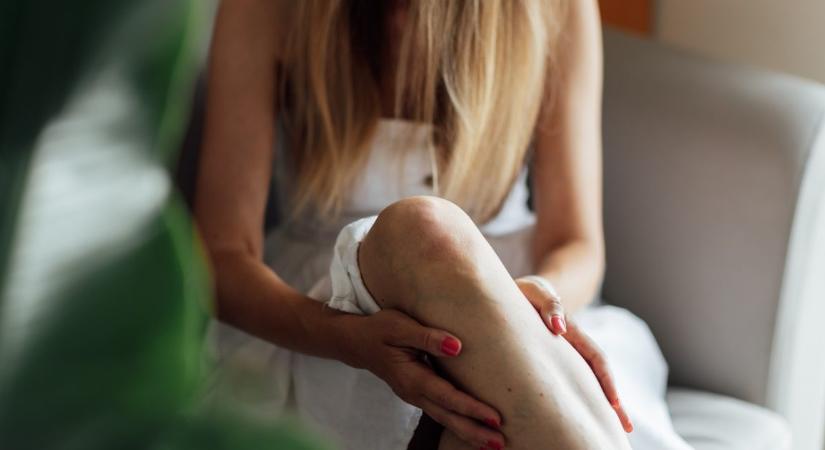 A lábdagadás szívelégtelenség jele is lehet – ezek a legbeszédesebb tünetek