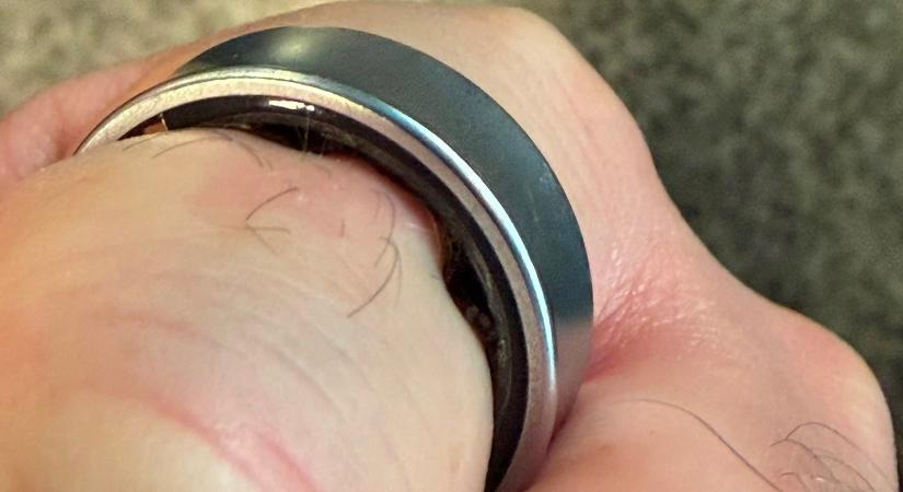 Nagy a baj a Galaxy Ring okosgyűrűvel, egy felhasználó ujjáról a kórházban kellett levenni