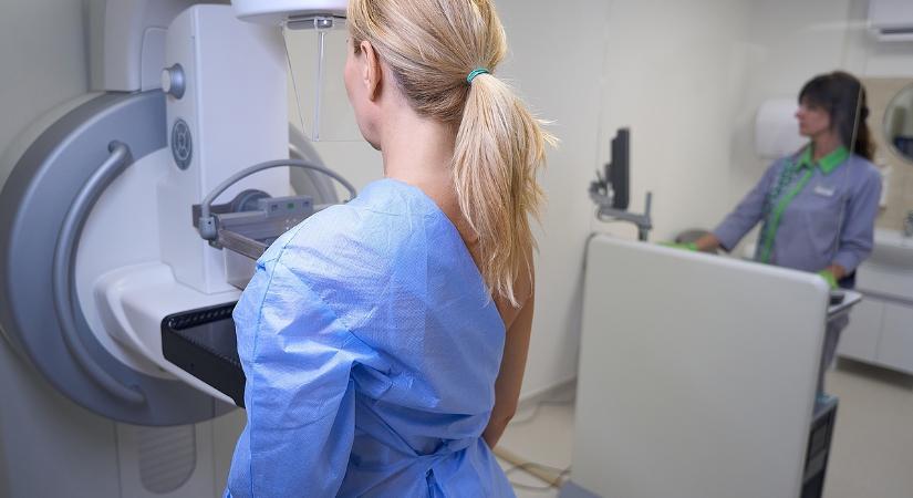 Drámai adatsort publikáltak – Harmadával nőtt a 40 év alatti mellrákos nők száma Magyarországon