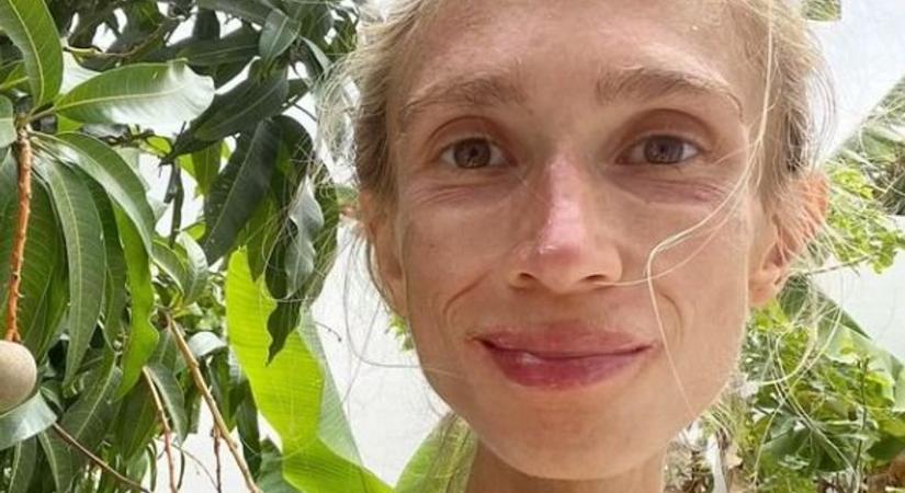 Éhen halt egy 27 éves nő, miután egy bizarr diétára váltott