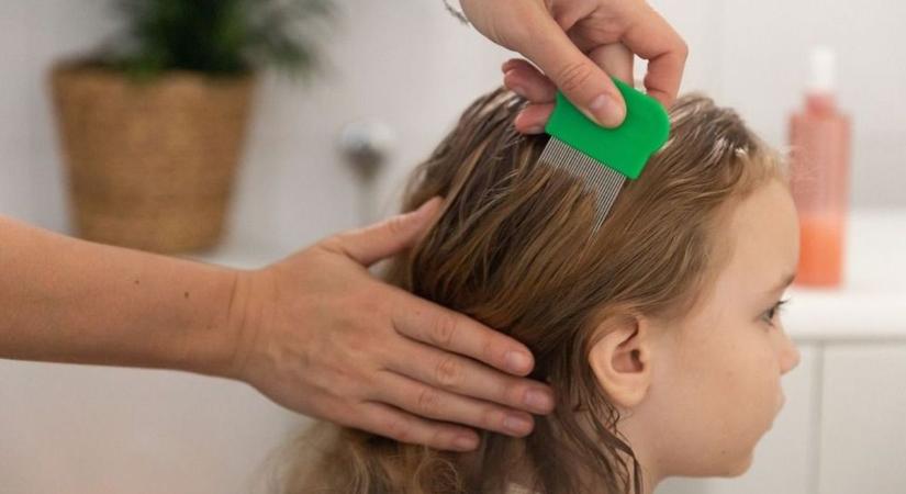 Gyors reagálás, hatékony kezelés – Így győzzük le a fejtetűt