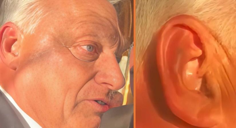 Hadházy talált valamit Orbán Viktor fülében, Orbán kiröhögte