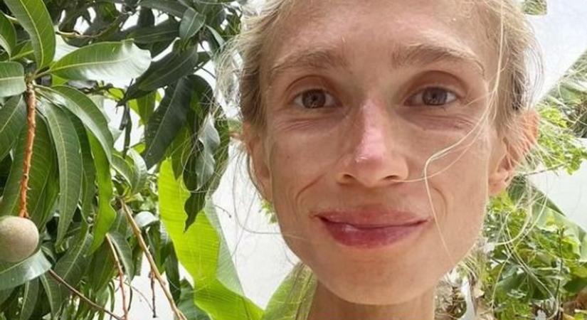 Ijesztő étrendet követett: halálra éheztette magát a fiatal lány