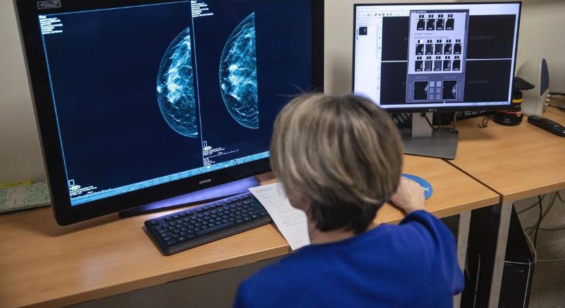 Minden tizedik magyar nőt érint a mellrák, ezeket a tüneteket nem szabad figyelmen kívül hagyni