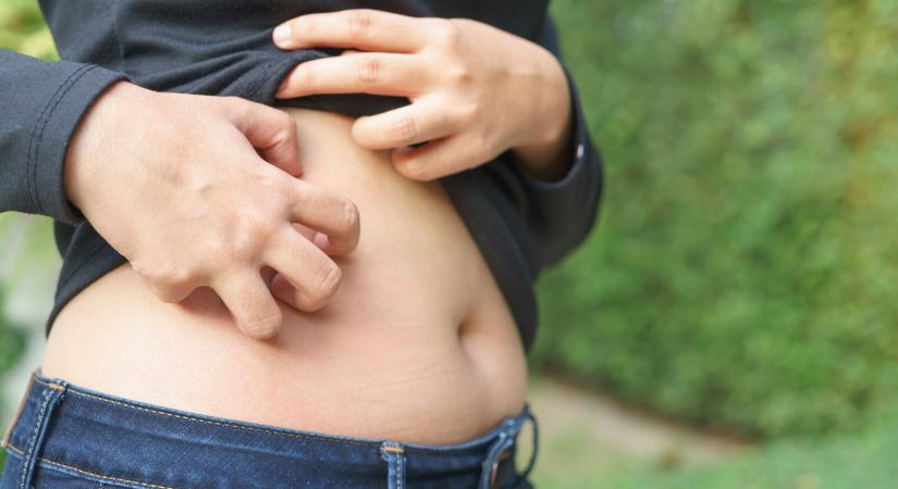 Vörös foltok, égető fájdalom: 72 órán belül orvoshoz kell menni ezekkel a tünetekkel