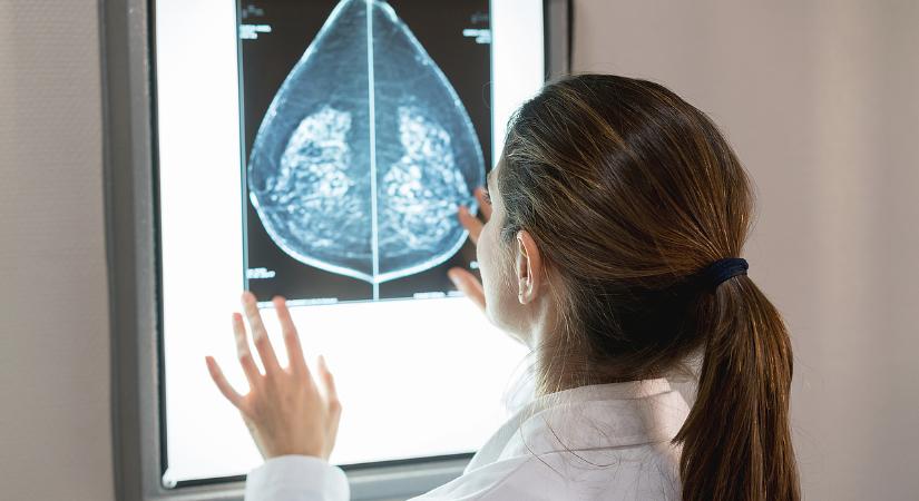 Egyre riasztóbb a helyzet, ezért bevetik a szupercsapatot