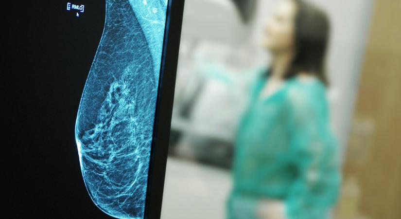 Azt a szót, hogy „rák”, sosem mondja ki – szakorvosok a daganatos betegségek gonoszságáról és mai magyar valóságáról