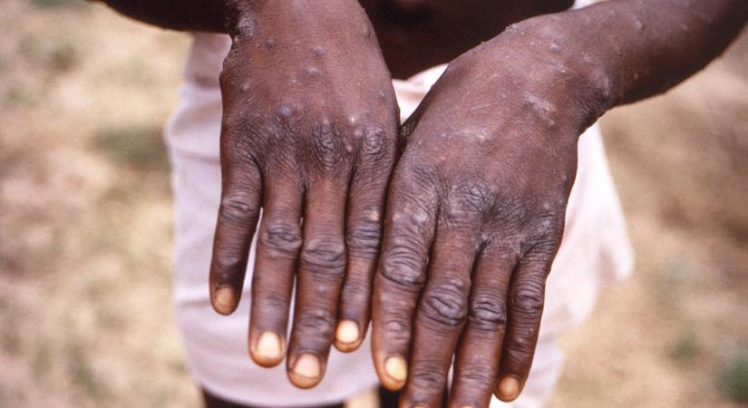 Több mint kétezer áldozata van a kegyetlen afrikai vírusnak
