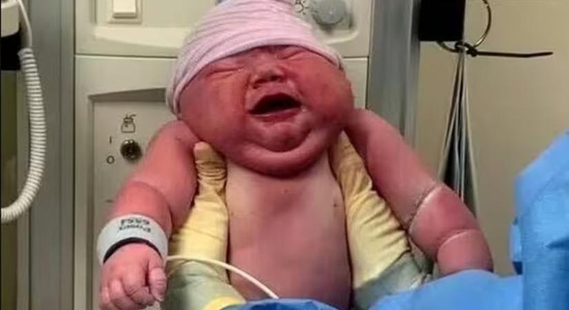 Közel 6 kilós baba született az Egyesült Államokban