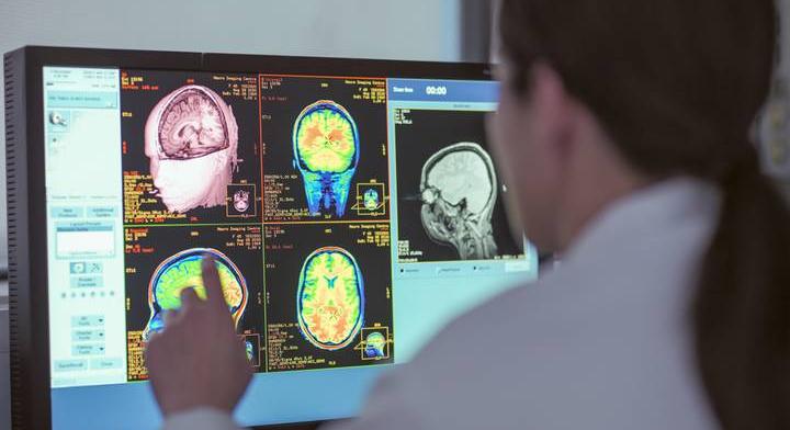 Az agy képes megnyújtani az időt: sci-fibe illik a felfedezés