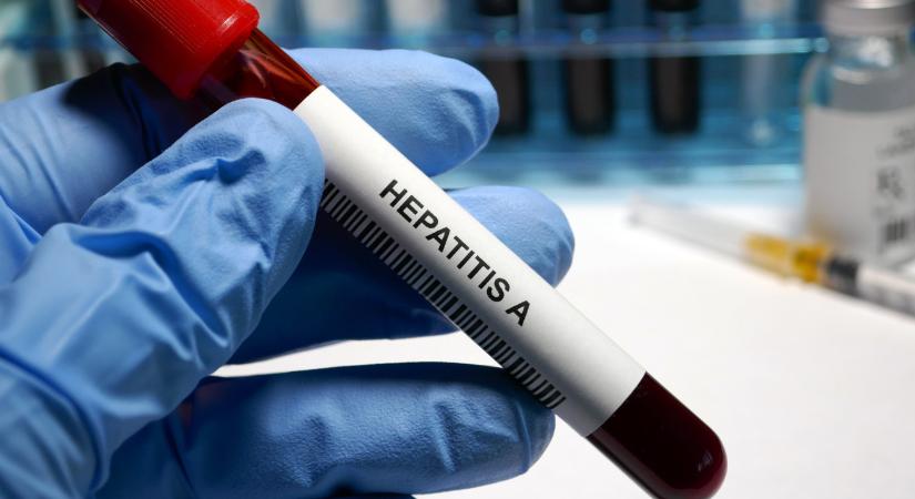 Nem gyengül a két hónapja tartó hepatitis-járvány