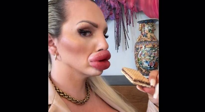 „Nekem vannak a világon a legnagyobb ajkaim – valamiféle Lego projektnek tekintem magam”