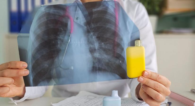 E-cigitől omlott össze egy férfi tüdeje: "Úgy éreztem, mintha mellkason lőttek volna"