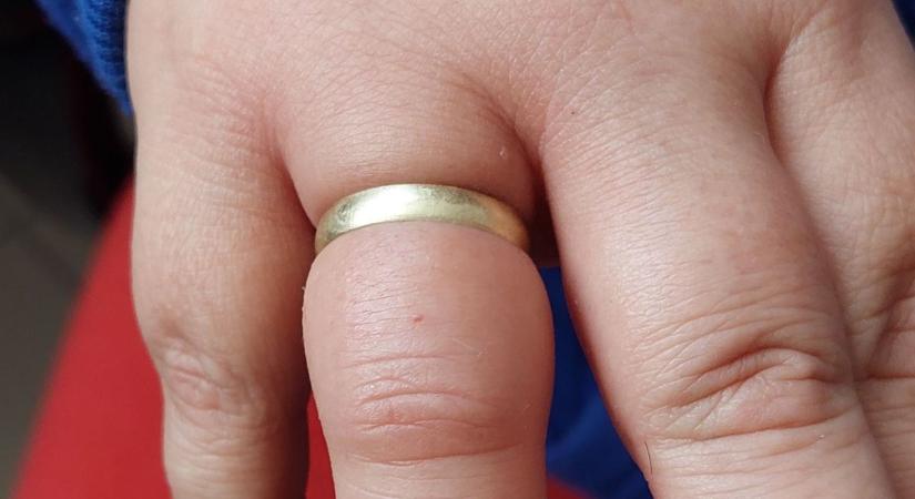 Tűzoltók és mentők is kellettek: odalett a karikagyűrű, csattant az olló a hölgy ujján