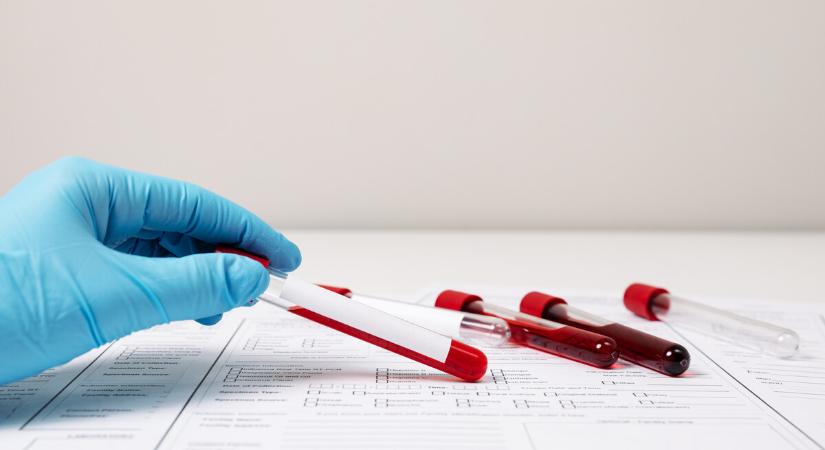 Elképesztő áttörés jöhet a rengeteg ember halálát okozó betegség gyógyításában – Egyetlen teszt mindent megváltoztathat