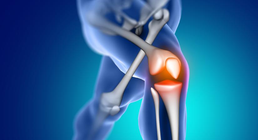 Az egyik leggyakoribb ízületi probléma: a porckopás
