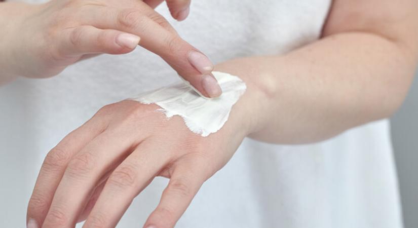 Sötét foltok vannak a kezeden? Mutatjuk, mit tehetsz ellenük