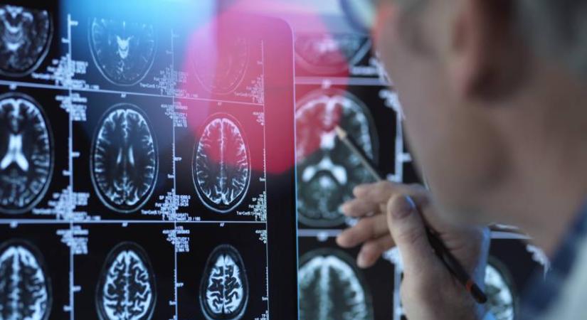 Ez az ital már kis mennyiségben is növeli a demencia kockázatát – A magyarok nagy része fogyasztja