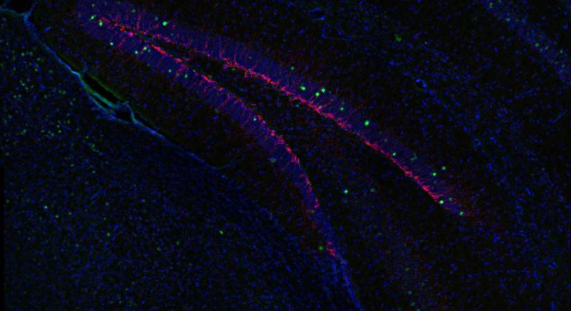 Azonosítottak egy vegyületet az agyban, ami magyarázatot adhat a felnőttkori depresszióra