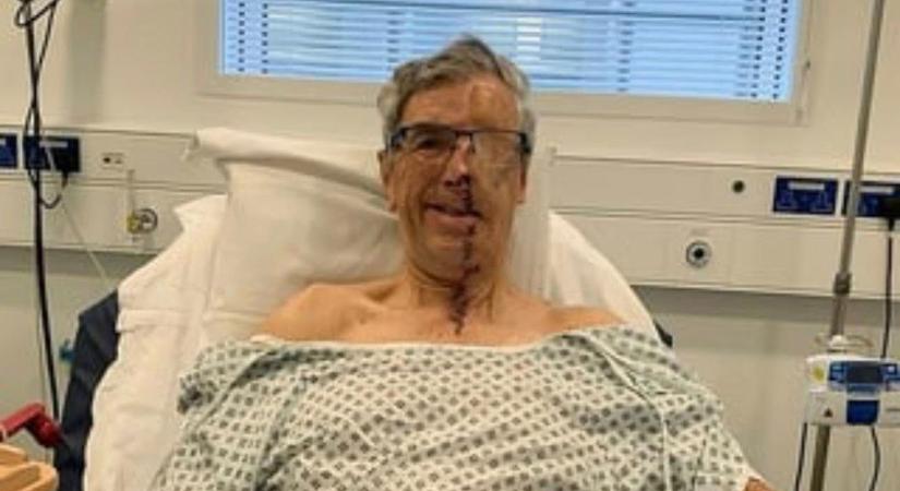 Ebbe beleszakad a szív: a férfi elvesztette fél arcát a brutális balesetben – most megrázó vallomást tett