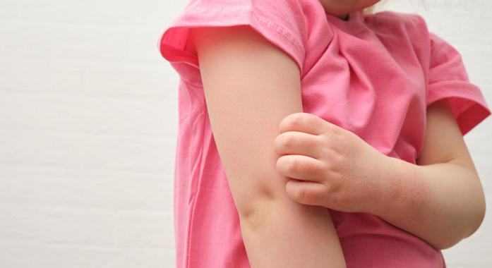 Atópiás alkat, atópiás betegségek