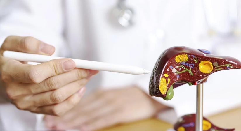 Ételek, amelyek tönkreteszik a májad – és nem az alkohol a legnagyobb ellenség