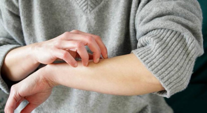 Ez az egyszerű bőrtünet súlyos problémára utalhat: muszáj időben észrevenni