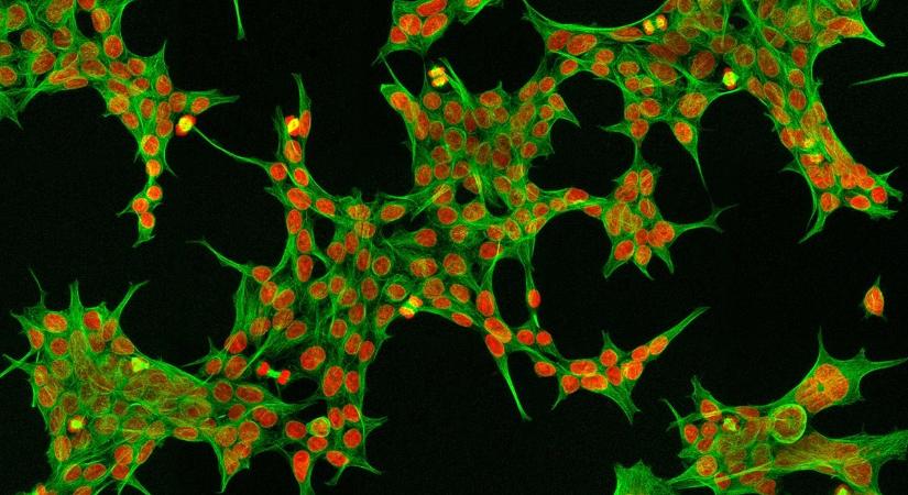 Orrot adtak a sejteknek a parfümkutatók