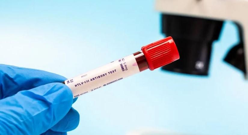 Lassabban öregszik, akinek ilyen a vércsoportja