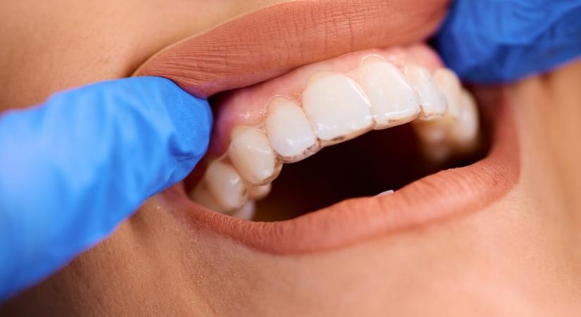 Többet nyújtunk, mint gondolnád – a győri Dent Art Klinik nem csak implantátum