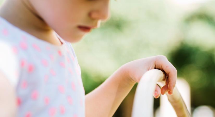 Fura zúzódások jelentek meg a kisfiú karján: mindenkit megdöbbentett a diagnózis