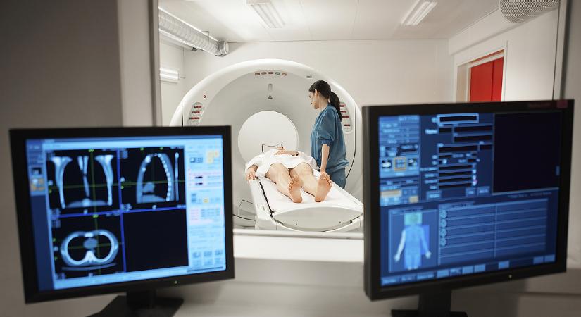 Elindul az államosított CT- és MRI-ellátás, az OKFŐ szerint biztosított a személyzet
