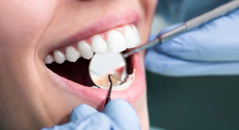 Ezért nem szeretik a fogorvosok az almát – és még 4 étel, ami az ellenségünk szerintük