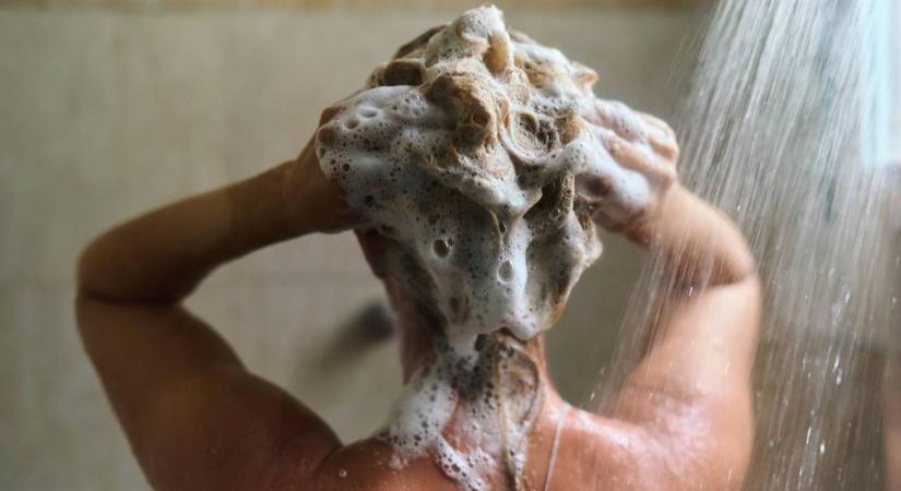 Beismerte a világsztár: 3 hónapja nem mosott hajat – Kiakadtak a netezők