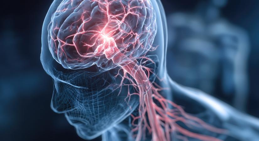 Homályos látás? Elnehezülő kar? – A stroke előjelei lehetnek