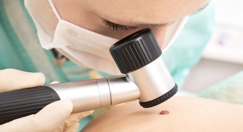 Ha ezt az öt tünetet tapasztalod magadon, tuti, hogy a májaddal van baj