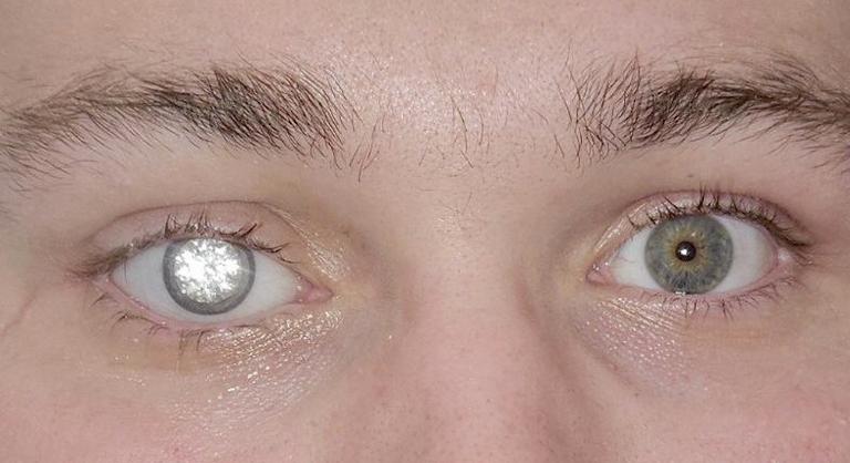 A csillagszemű juhász után itt a gyémántszemű üzletember