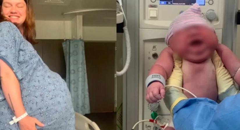 FOTÓK: Mikor meglátták és megmérték az újszülöttet, elállt a lélegzetük