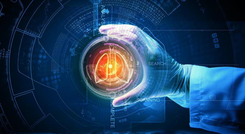 November 8-a az utolsó tüdőrákszűrő nap a SOLACE projektben