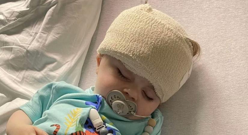 „Azt hitték, csak lassabban fejlődik”- Szilva nagyságú agydaganat nőtt a 10 hónapos fiúnak