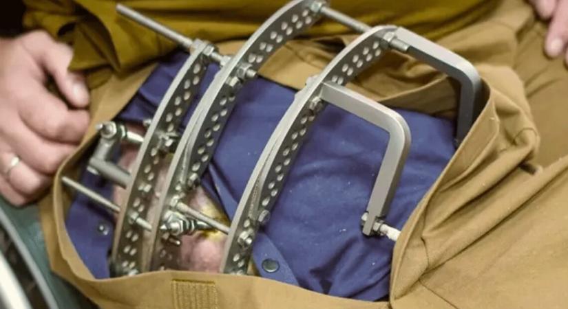 Megkezdődött a „Sebesültcsomag” kiosztása az ukrán katonáknak