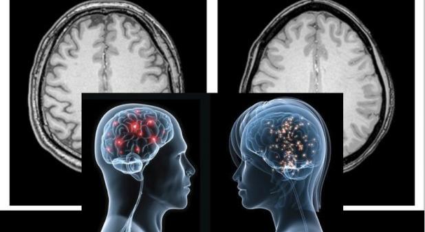 Az agyunk képes megjósolni a jövőt