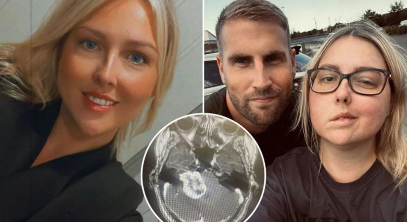 „Nem tudok mosolyogni, miután a dokik kinevették a fejfájásomat, miközben egy gigantikus daganat nőtt 10 éven át bennem”