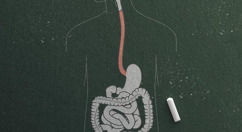 Ezekkel a trendekkel teljesen tönkreteheted az emésztésed