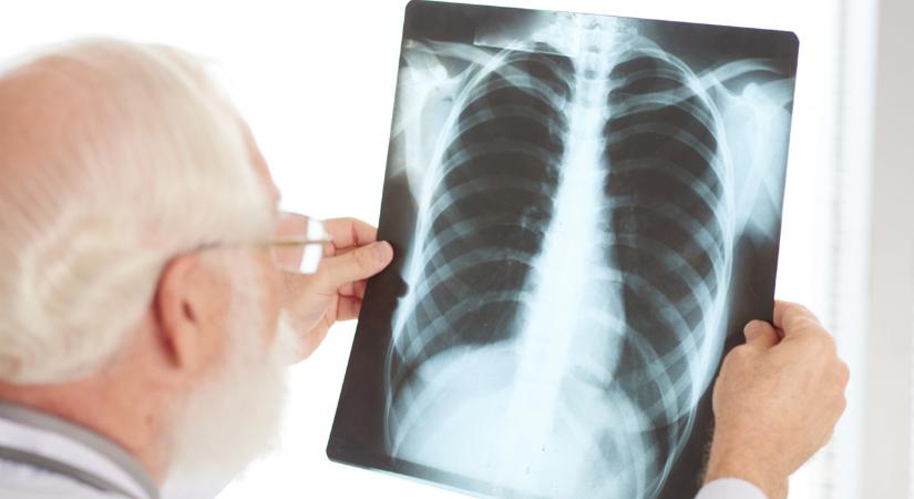 „Egy nap a tüdő egészségért”