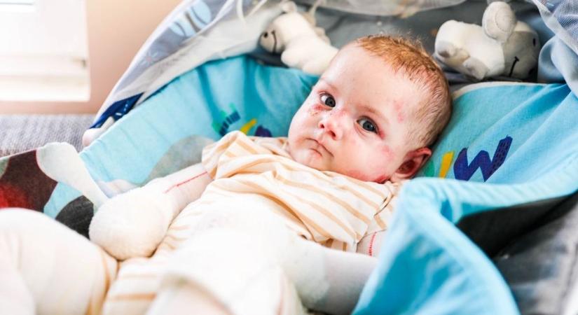 Összefogott a környék a pillangóbőrös kis Somáért – jótékonysági bál és sütivásár lesz Rábahídvégen