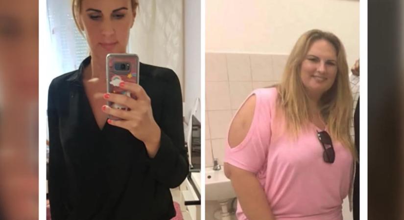 Diéta – Kunovics Katinka 40 kilós fogyásának nehézségeiről beszélt: Nem akarok még egyszer ilyen fájdalmat érezni!