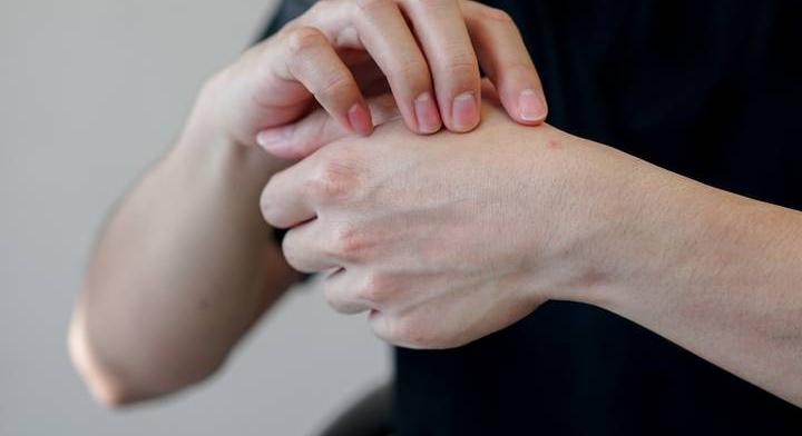 Félelmetes rovarfaj terjed Magyarországon: emberekre is veszélyes